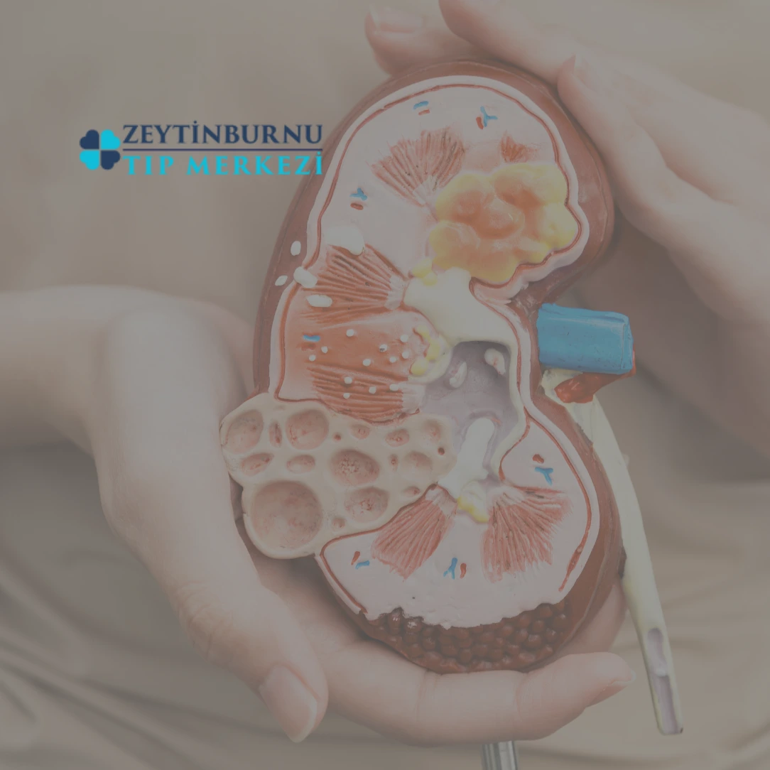 Böbrek Taşı ve Böbrek Kumu